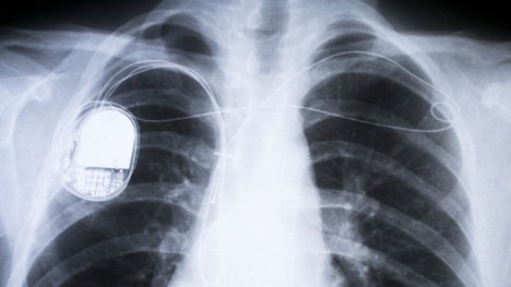 Although there are no known instances of someonehacking a pacemakeror similar device to harm another person in real life, the danger is real. That's why researchers at Rice University in Houston decided to look for a better way to protect people's IMDs.